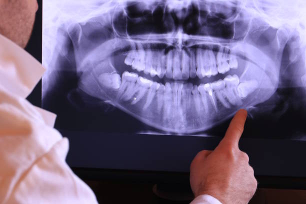 Best Urgent Care for Lost Fillings or Crowns in Eaton, OH