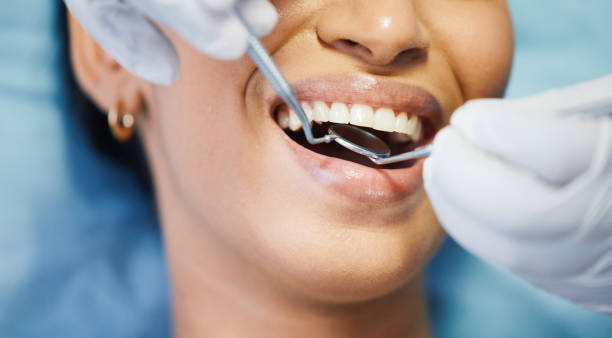 Best Emergency Tooth Extraction in Eaton, OH